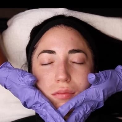 Chemical Peel Series at Empowered Esthetic in Rancho Santa Margarita, CA